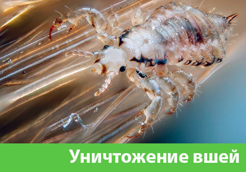 Уничтожение вшей в городе Сарапул